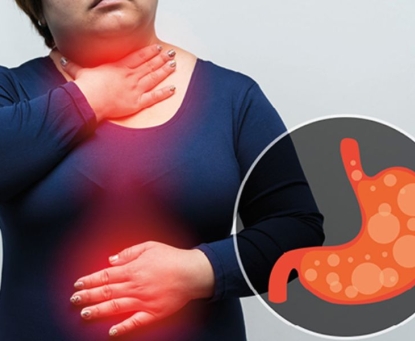 Kiểm soát cân nặng giảm nguy cơ ung thư thực quản